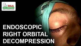 Endoscopic  Right Orbital  Decompression of 13yr old child  || MAA ENT Hospitals || Dr.K.R.Meghanadh