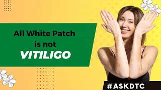 How to identify Vitiligo or white spots on the skin | Dr. Rohit Goel