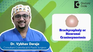 Broad & Short Head In Babies | Bicoronal Craniosynostosis #child -Dr. Vybhav Deraje| Doctors' Circle