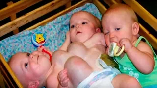 Родители отказались от детей, когда узнали, что они сиамские близнецы. Жизнь детей спустя 16 лет