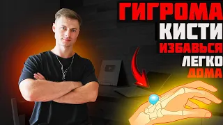 Гигрома кисти. Избавься легко!