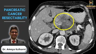 Pancreatic Cancer Resectability - What Radiologists Need To Know!