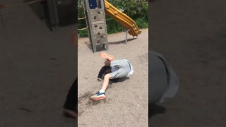 Kid dies parkour (brokes his arm)