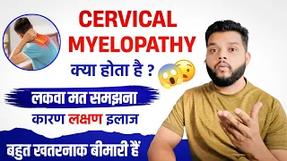 सरवाईकल मेलोपैथी कारण और इलाज | Cervical Myelopathy Causes, Symptoms & Treatment