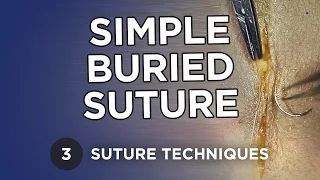 Simple Buried Suture - Learn Suture Techniques