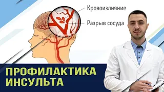 Профилактика инсульта. Улучшение мозгового кровообращения