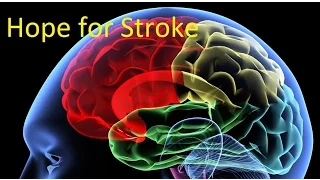 Hope for People Who Have Experienced a Stroke
