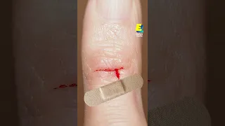 Why Do Papercuts Hurt So Much?