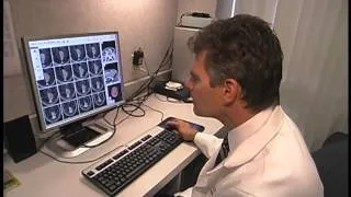 Brain Tumor Gamma Knife Video