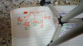 ALLERGIC CONJUNCTIVITIS summary of all types in easy form