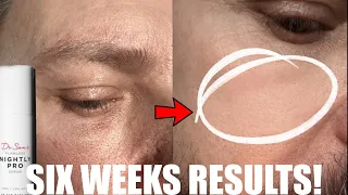 I TRIED DR SAM NIGHTLY PRO FOR SIX WEEKS! THIS IS THE RESULTS!