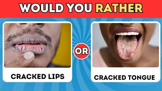 Would You Rather...? HARDEST Choices Ever! 😱😨 Extreme Edition