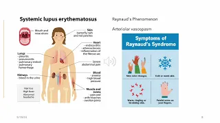 Connective Tissue (Autoimmune)Disorders