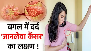 बगल में दर्द होने का कारण, Lymph Nodes से लेकर Breast Cancer का खतरा | Boldsky