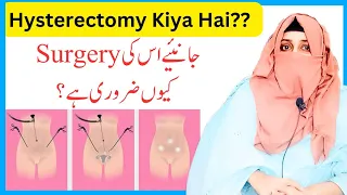 Hysterectomy In Urdu/Hindi | What is Hysterectomy | Hysterectomy by Dr Rida Ahmed