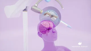 How TMS Works: A Step-by-Step Explanation of How Transcranial Magnetic Stimulation Treats Depression