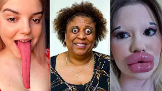 Top 10 People With The Largest Body Parts In The World