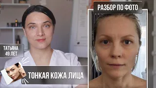 Тонкая кожа лица. Убираем межбровку. Мои рекомендации