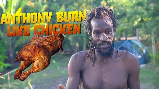 Anthony burn up like a Roasted Chicken!