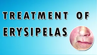 Erysipelas Symptoms, Treatment, and Causes