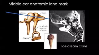 Imaging of Petrous bone part 1  Anatomy    Dr Mamdouh Mahfouz