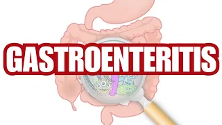 ¿QUE ES LA GASTROENTERITIS? | SIGNOS Y SINTOMAS