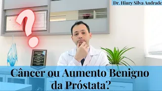 Câncer ou aumento benigno da próstata? – Dr. Hiury Silva Andrade