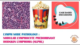 Lymph node pathology - Nodular lymphocyte predominant Hodgkin lymphoma (NLPHL)