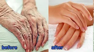 old hands look young remove wrinkles from hands and fingers