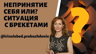 Что это? Непринятие себя? Ситуация с брекетами - психолог Ирина Лебедь