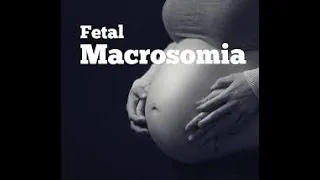 Fetal Macrosomia