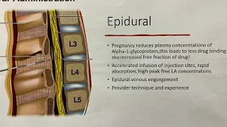 Local Anesthetic Systemic Toxicity