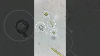 Microorganisms Under Microscope [Part 1] | Learn Practically #euglena #paramecium #science