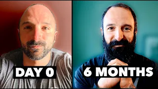6 MONTHS NO ALCOHOL! (3 Unexpected Benefits of Getting Sober)