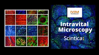 IVIM Microscopy