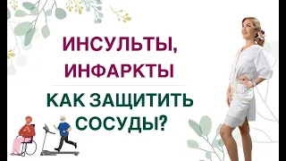 ❤️ ИНСУЛЬТЫ, ИНФАРКТЫ.КАК ИЗБЕЖАТЬ❓ХОЛЕСТЕРИН, ГОМОЦИСТЕИН Врач эндокринолог, диетолог Ольга Павлова