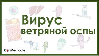 Вирус ветряной оспы (ветрянка и опоясывающий лишай) - клиника, диагностика, лечение