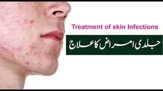 Treatment of Skin Infections || جلدی امراض کا آسان علاج