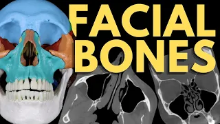 Facial Bones | Viscerocranium Anatomy | Radiology Anatomy Part 1 | CT Brain