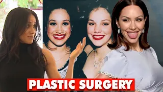 BUST! Katharine McPhee Foster Posted A Throwback Photo That Proves MEGHAN HAS 'PLASTIC SURGERY'