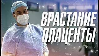 Врастание плаценты. д.м.н. Оводенко Дмитрий Леонидович. Москва.