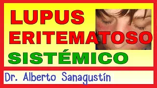 LUPUS ERITEMATOSO SISTÉMICO (LES) Síntomas, Fisiopatología y Tratamiento.