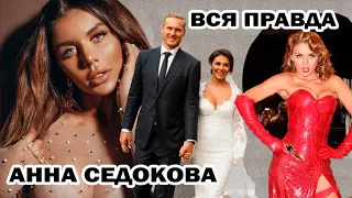 Вся правда об Анне Седоковой! Мужчины, карьера, дети