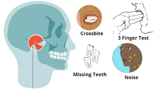 Is Your Jaw UNBALANCED -  Uneven Jaw: Causes, Treatments (MUST KNOW)