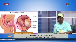 Prostate Cancer: Causes Symptoms and Treatment