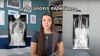 my scoliosis story - having a back brace and 2 spinal fusions 🩻