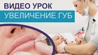 Как увеличивать губы ВИДЕО УРОК, Princess Volume (гиалуроновая кислота), контурная пластика губ