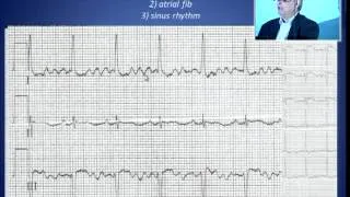 ECG Quiz - Dr Martin Green 27.09.2013 14