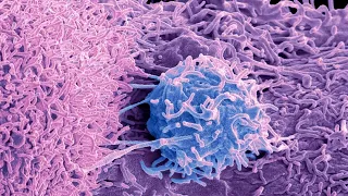 Push to increase prostate cancer testing