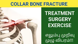 எலும்பு முறிவு முழு விபரம்!!! Clavicle Fracture / Collar Bone Fracture